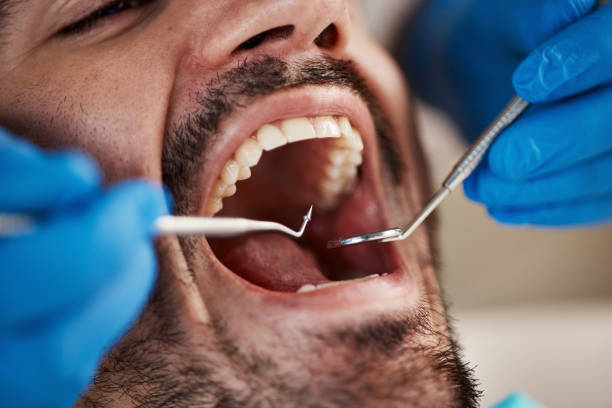 Best Emergency Treatment for Oral Infections in Woodinville, WA